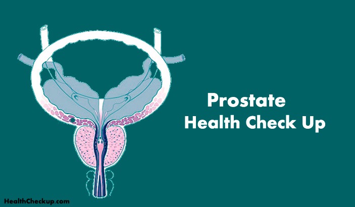 Prostate Cancer Check Up-tests and treatment for cancer