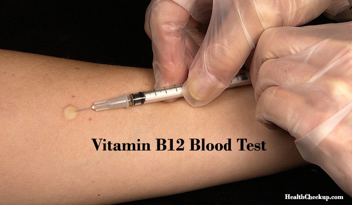 Vitamin B12 Test reasons and benefits procedure