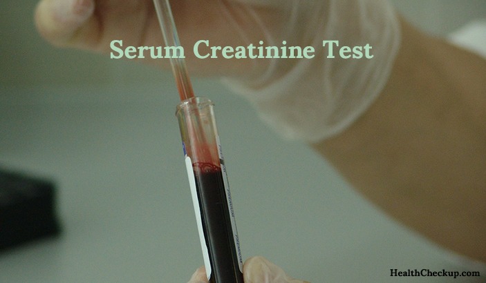 Serum Creatinine Test -procedure results and purpose