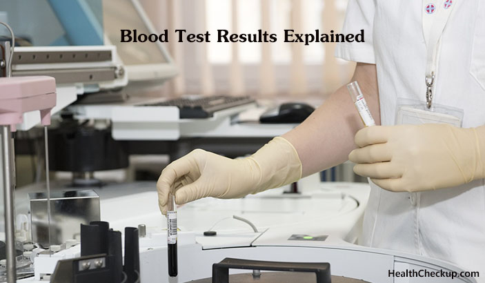 lab test results