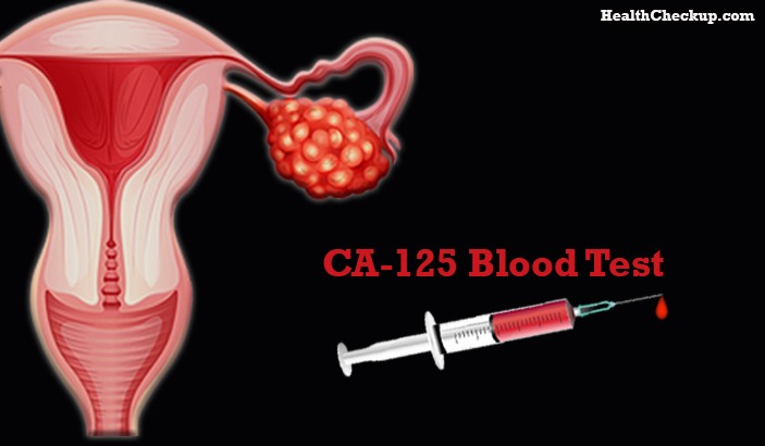 ca-125 blood test