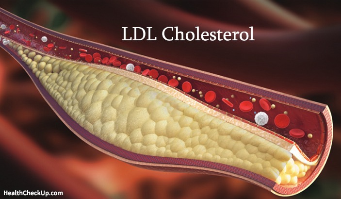 What is LDL cholesterol test-ldl cholesterol normal range