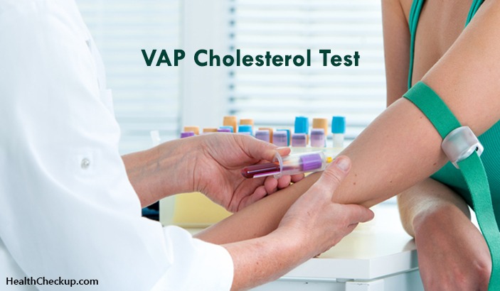 VAP Cholesterol Test Procedure ,Preparation