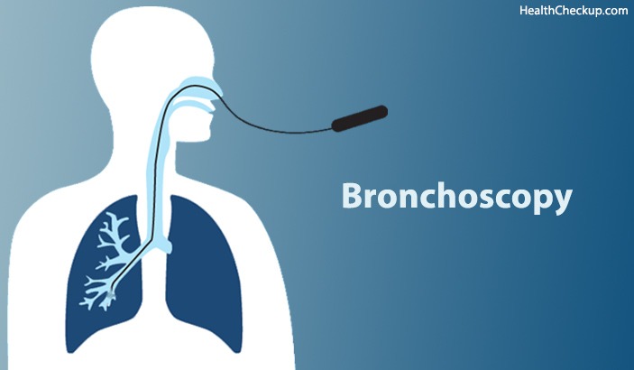 Bronchoscopy Procedure & Complications