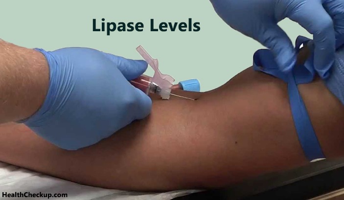 Lipase Levels