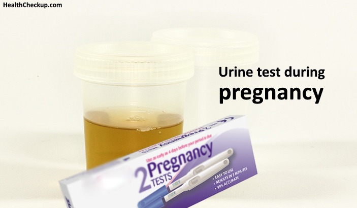 Urine test during pregnancy