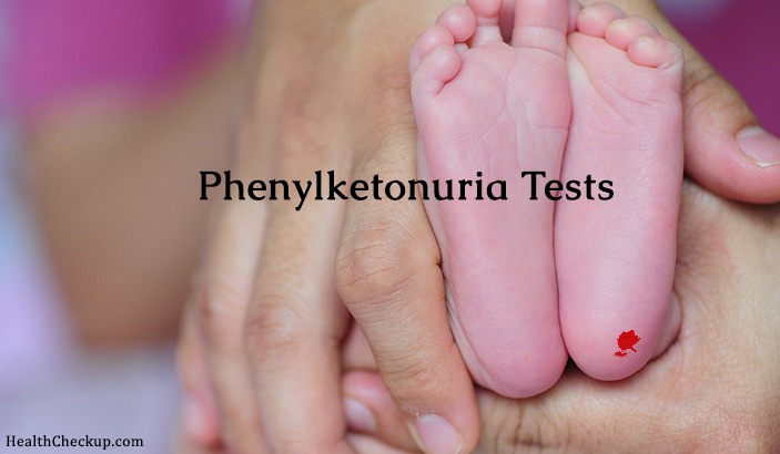 Phenylketonuria Tests | Treatment and symptoms