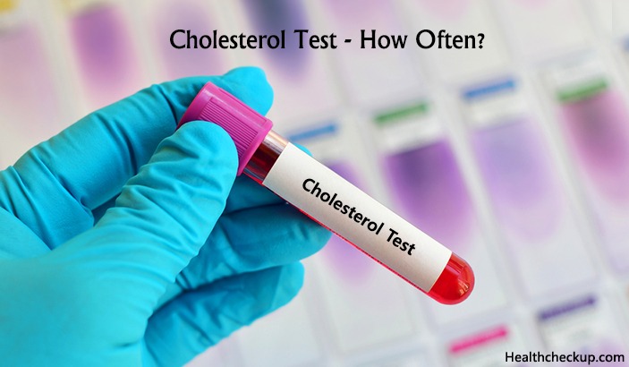 cholesterol check up