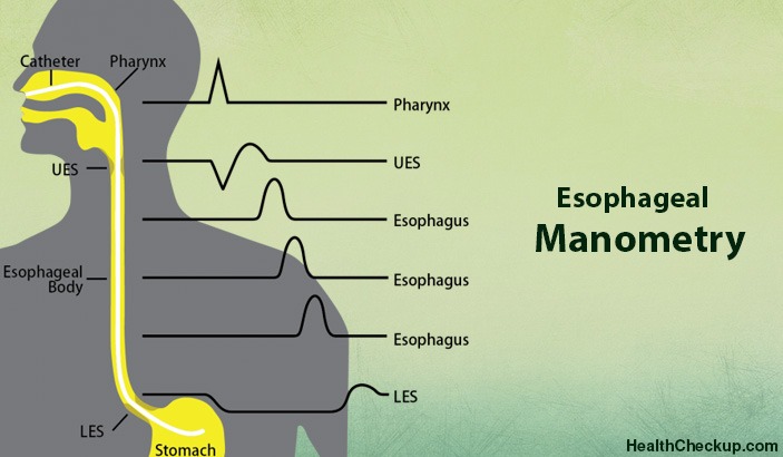 Esophageal Manometry Test Procedure and side effects