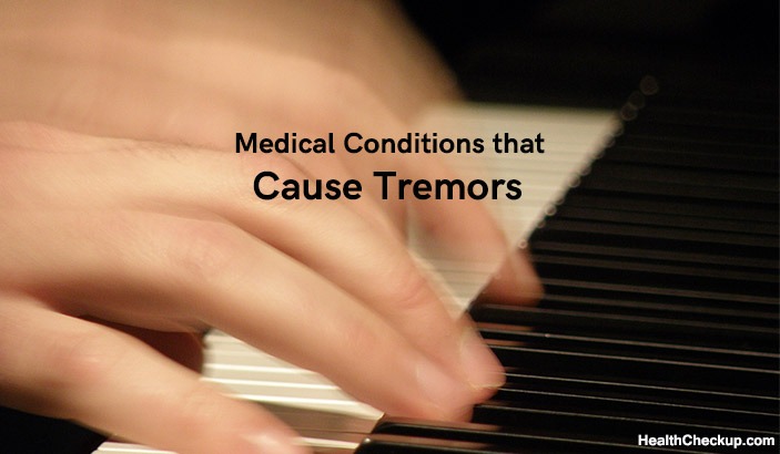 Tremors Types, Causes and Treatment