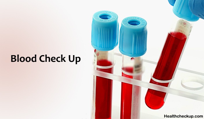 Why Blood Check up is Important For Healthy People Too?