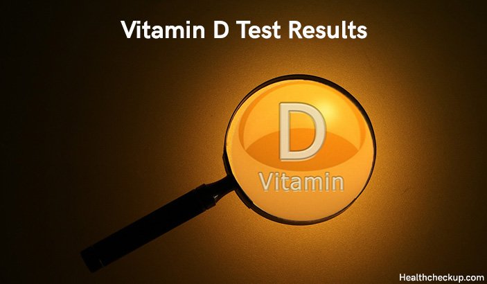 Vitamin D Test Results