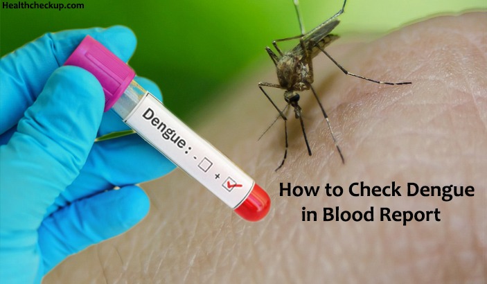 How to check dengue in blood report