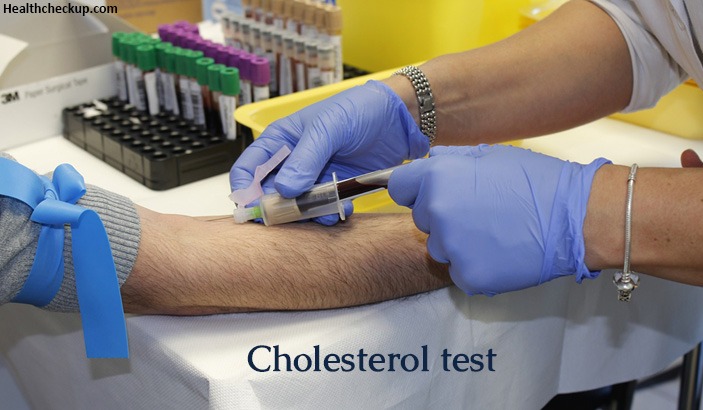 Cholesterol Test Results