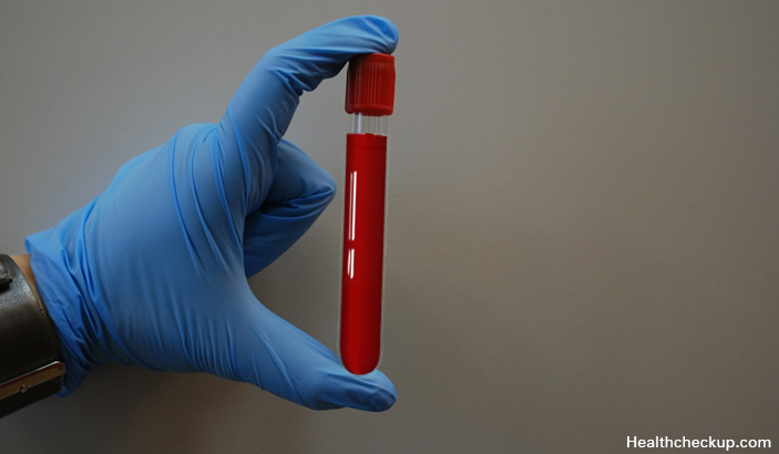 Blood Urea Nitrogen (BUN) Test-Creatinine Test