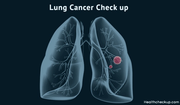 Lung Cancer Check up