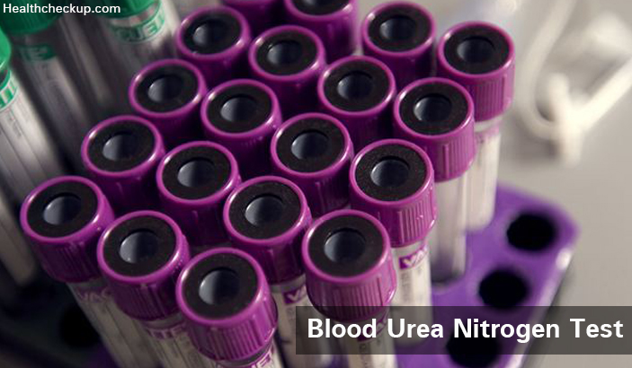 Blood Urea Nitrogen (BUN) Test