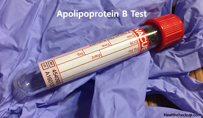 (ApoB)Apolipoprotein B test