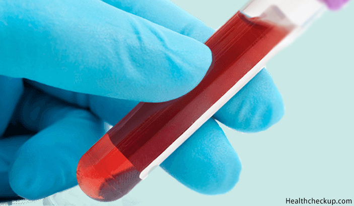 Order Blood Test for Iron Deficiency Test