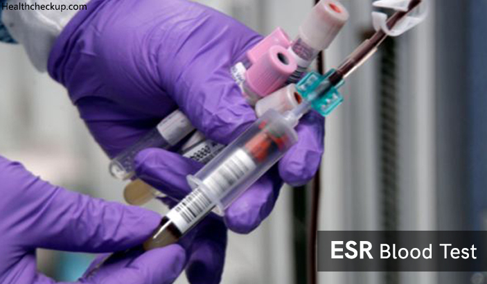 ESR test procedure and causes of low and high