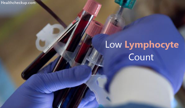 Low Lymphocyte Count: Causes, Symptoms and Normal Ranges