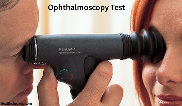 Ophthalmoscopy Test