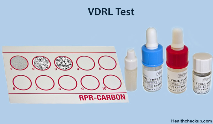 VDRL Test