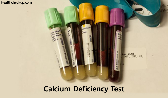 calcium deficiency test