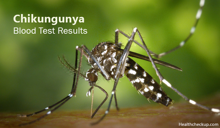 chikungunya blood test results