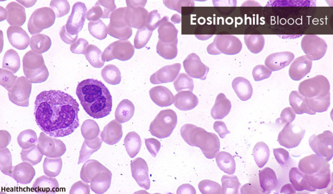 Eosinophils Blood Test Procedure Causes of Eosinophilia
