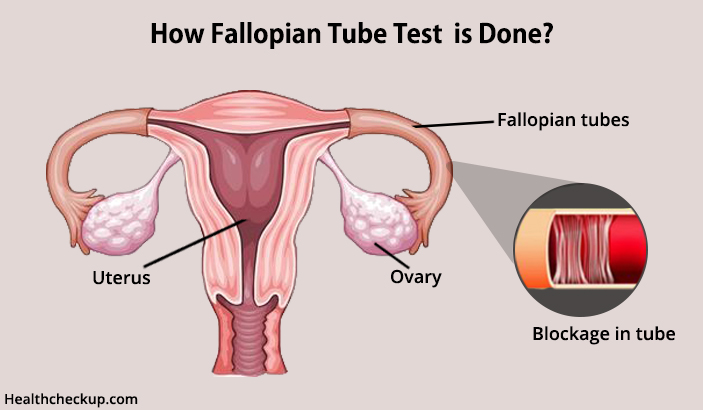 how fallopian tube test is done