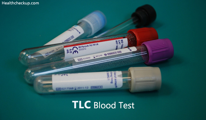 tlc blood test Normal Range
