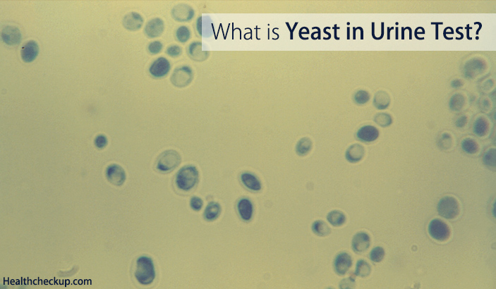yeast in urine test