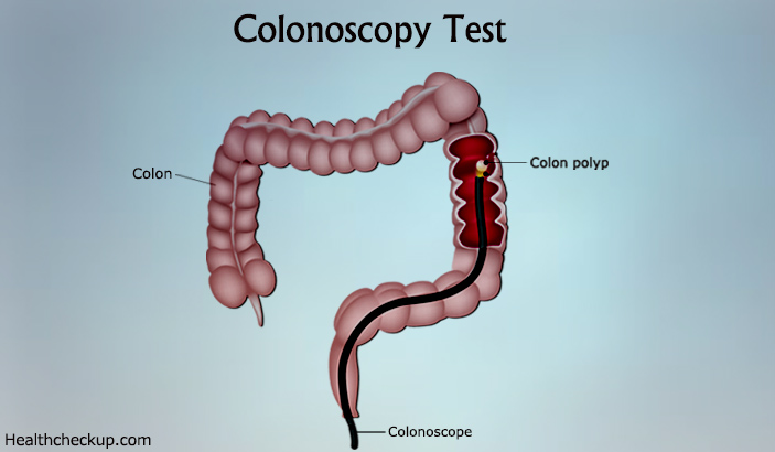 Colonoscopy Test procedure and preparation ,alternative to colonoscopy