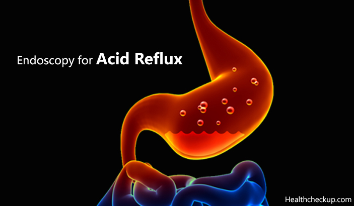 Endoscopy for Acid Reflux