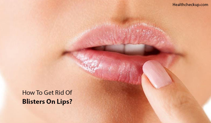 blisters on lips cause and know how to get rid of blisters on lip
