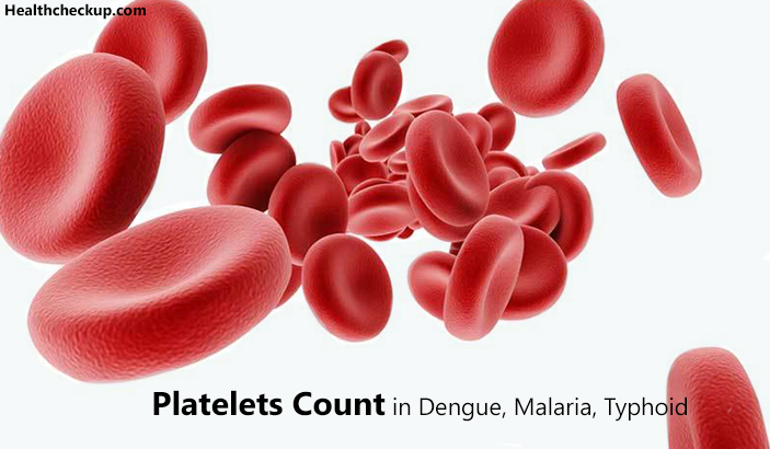 Platelets Count in Dengue Malaria Typhoid