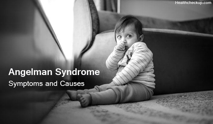 Angelman Syndrome-causes and symptoms and treatment