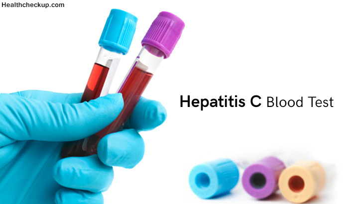 Hepatitis C Blood Test-7 things to know about test