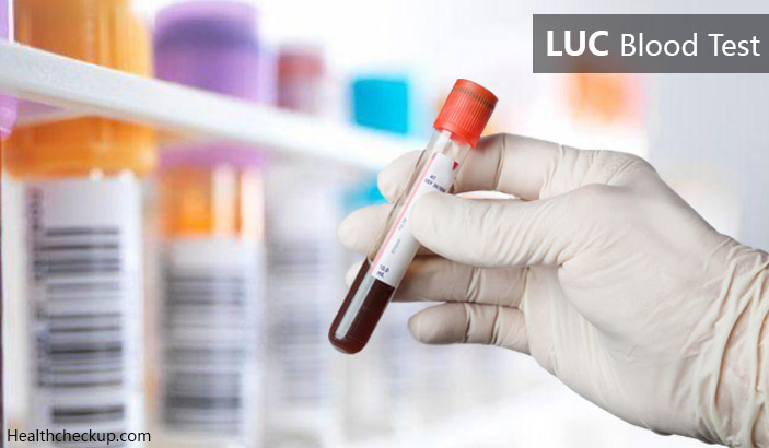 LUC Blood Test