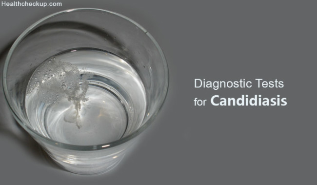 Candidiasis Test Use Symptoms Causes Treatment Results Pic
