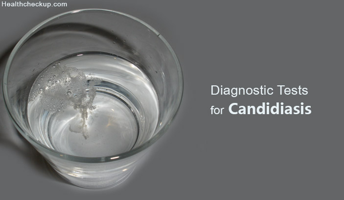 diagnostic tests for candidiasis