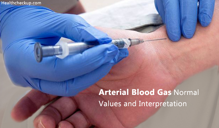 Arterial Blood Gas Normal Values