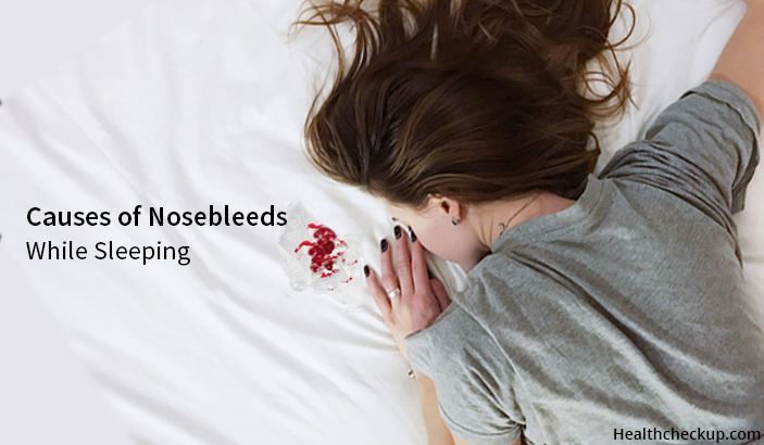 Causes of Nosebleeds while Sleeping