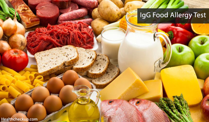 IgG food allergy test