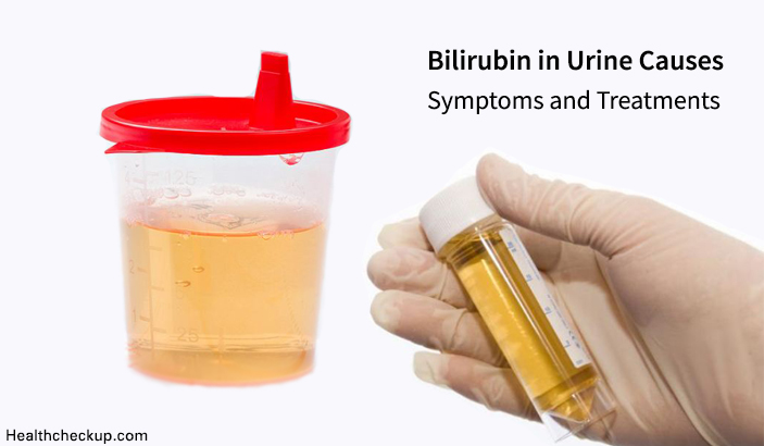 bilirubin in urine causes symptoms and treatment
