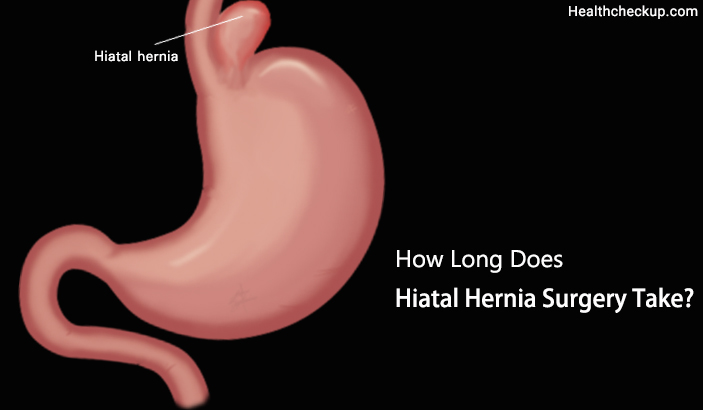 How long does Hiatal Hernia surgery take