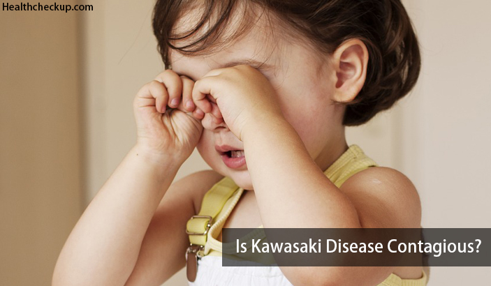 is kawasaki disease contagious?