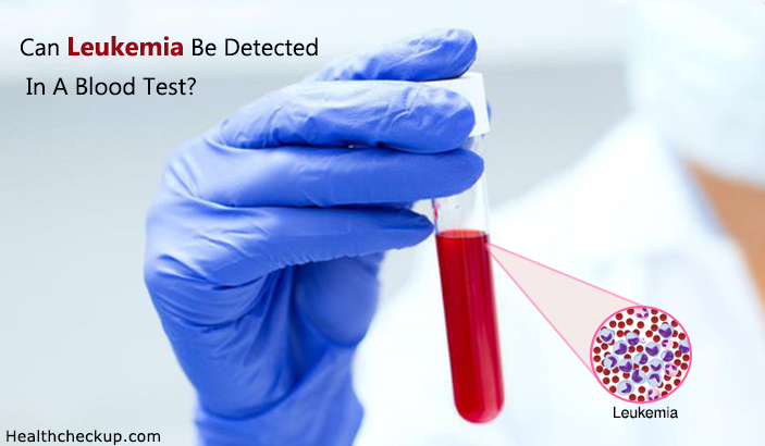 Can Leukemia Be Detected In A Blood Test?