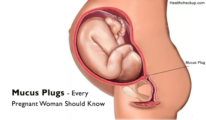 Mucus Plug - Every Pregnant Woman Should Know (With Pictures) Mucus Plug - Every Pregnant Woman Should Know (With Pictures)